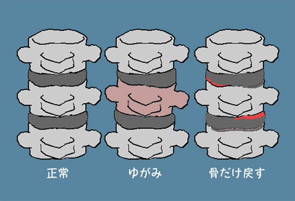 HSTI骨格調整法とは?
